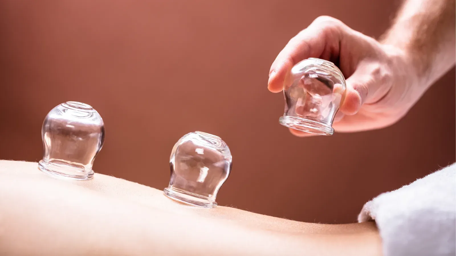 Three glass cups placed along a person's back, a hand positioning the fourth